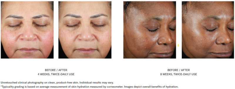 Skinbetter Science - Trio Luxe Moisture Treatment - Image 4